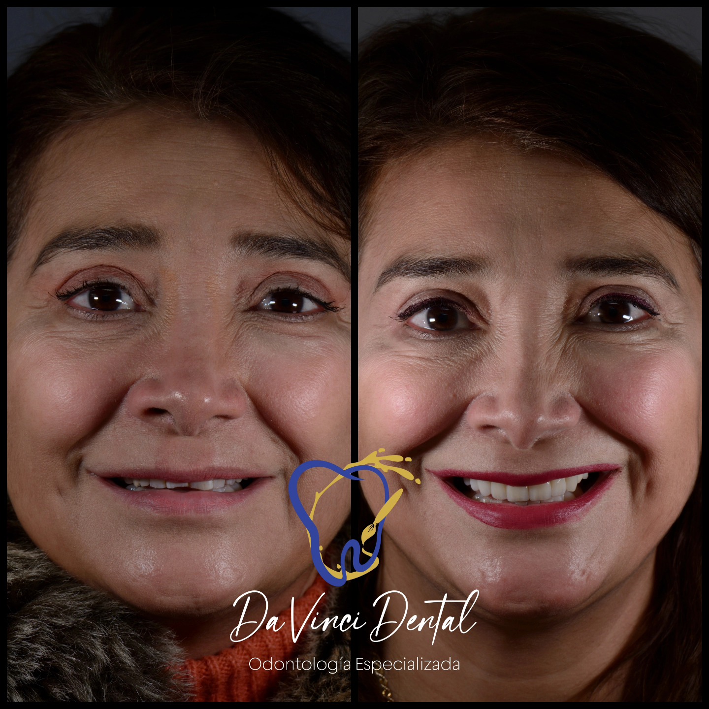 Caso 3 antes y después