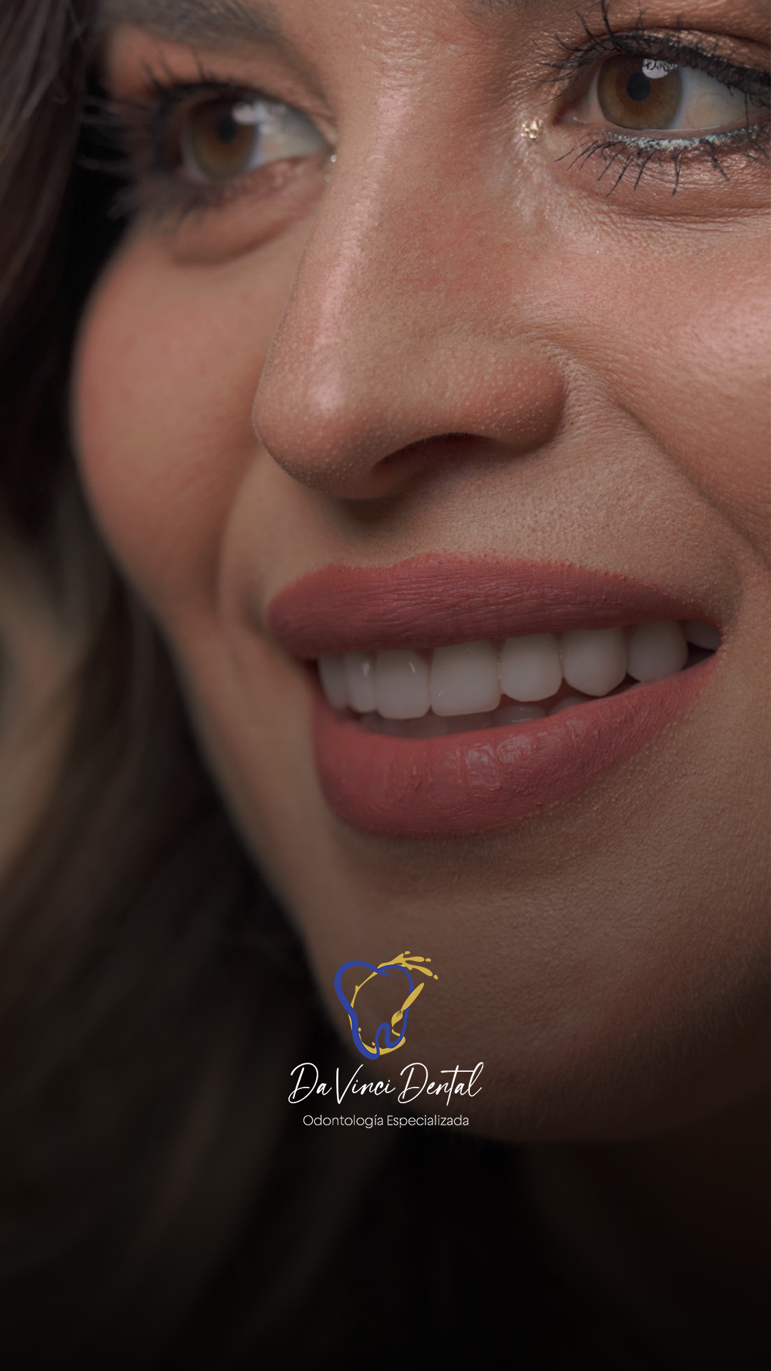 Testimonial Yessi Chaparro - Da Vinci Dental